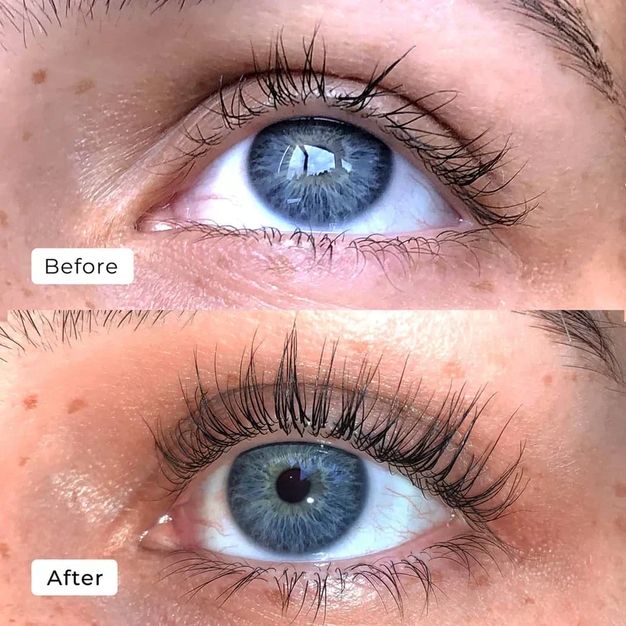2+1 Gratis | WimpernWuchs™ Natürlicher Wimpernschub - Image 2