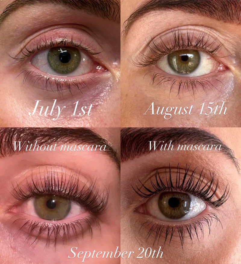 2+1 Gratis | WimpernWuchs™ Natürlicher Wimpernschub - Image 3