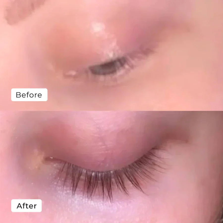 2+1 Gratis | WimpernWuchs™ Natürlicher Wimpernschub - Image 5