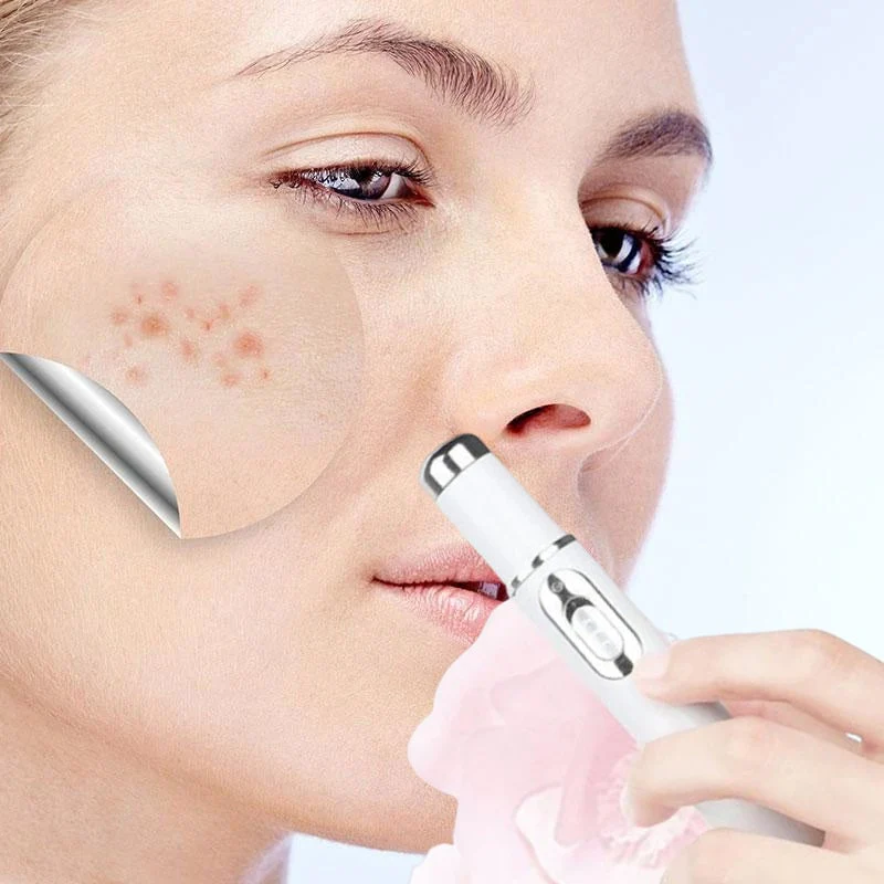 Avelena | ClearDerm - Schnelle, schmerzfreie Pickelentfernung für glatte, klare Haut - Image 5
