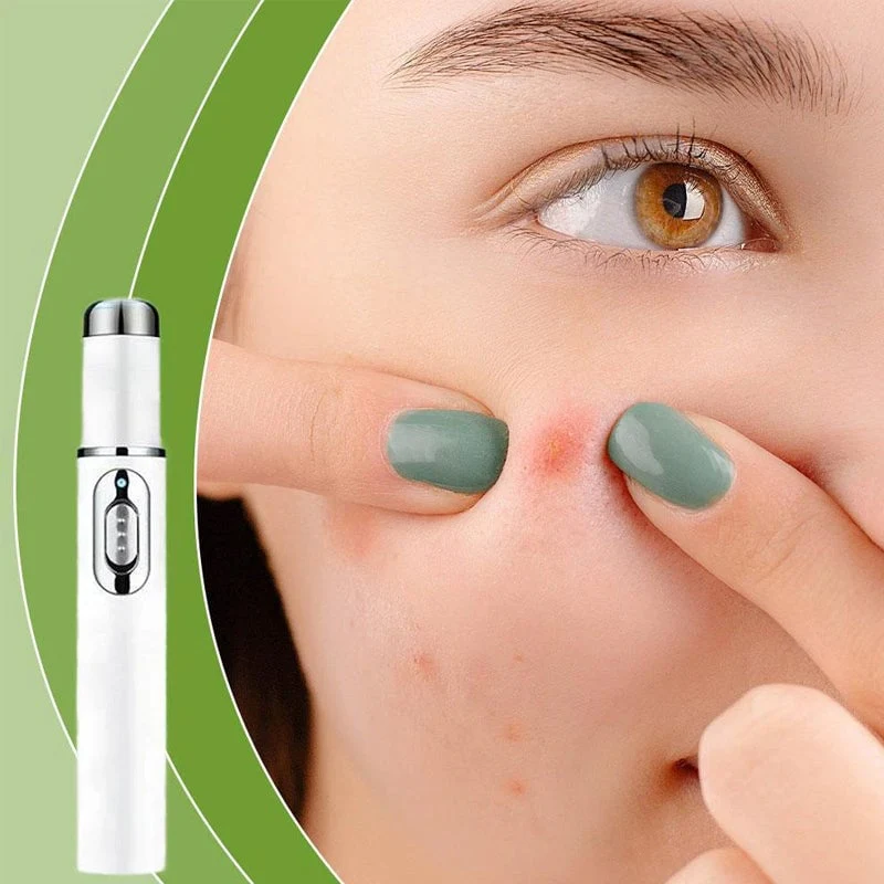 Avelena | ClearDerm - Schnelle, schmerzfreie Pickelentfernung für glatte, klare Haut - Image 6