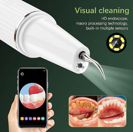 Dentora | Professioneller Ultraschall-Zahnsteinentferner für effektive Zahnpflege zu Hause - Image 3