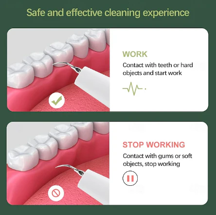 Dentora | Professioneller Ultraschall-Zahnsteinentferner für effektive Zahnpflege zu Hause - Image 5