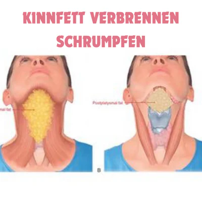 GesichtForm™ Definierende Kieferlinie Optimierung - Image 11