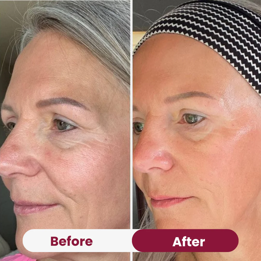GlanzMaske™ Jugendliche Haut Maske - Image 6