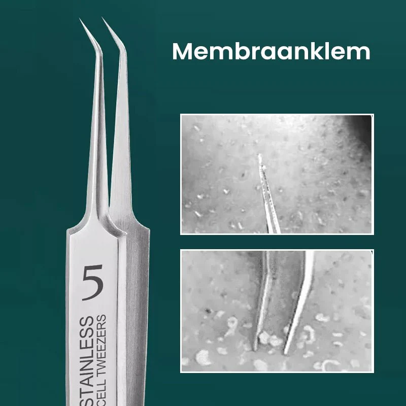 HautGreif™ Zielgerichtete Pickelentfernung - Image 7