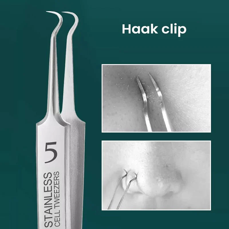 HautGreif™ Zielgerichtete Pickelentfernung - Image 8