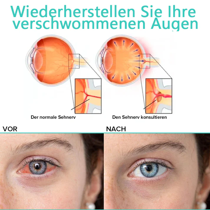 KlarTropfen™ Rötung Schnell Lindern - Image 10
