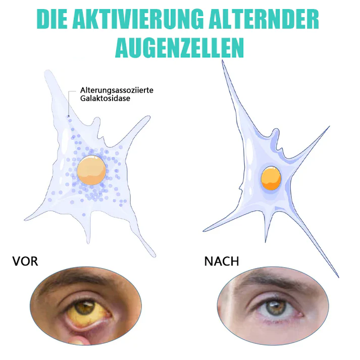 KlarTropfen™ Rötung Schnell Lindern - Image 2