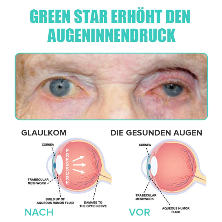 KlarTropfen™ Rötung Schnell Lindern - Image 8