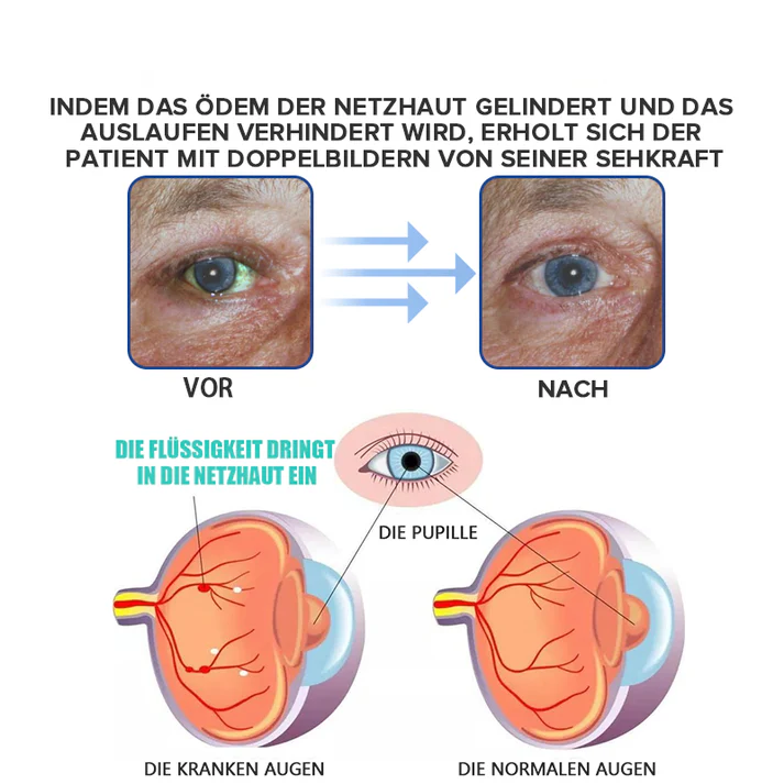 KlarTropfen™ Rötung Schnell Lindern - Image 9