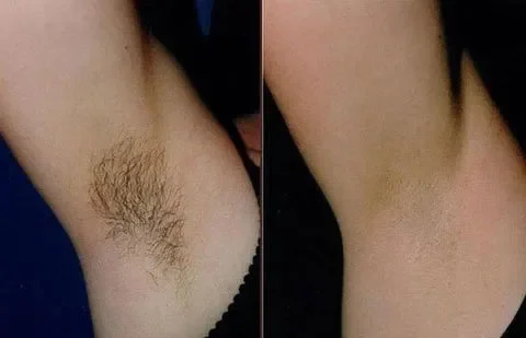 SanftHaut™ Lang anhaltendes geschmeidiges Selbstvertrauen - Image 3