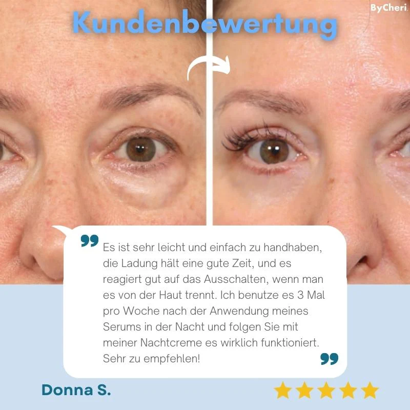 SeidenAuge™ Müde Augen wiederbeleben - Image 7