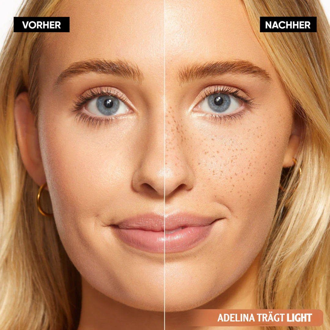 SonnenPunkte™ Verspielter Beauty-Akzent - Image 7