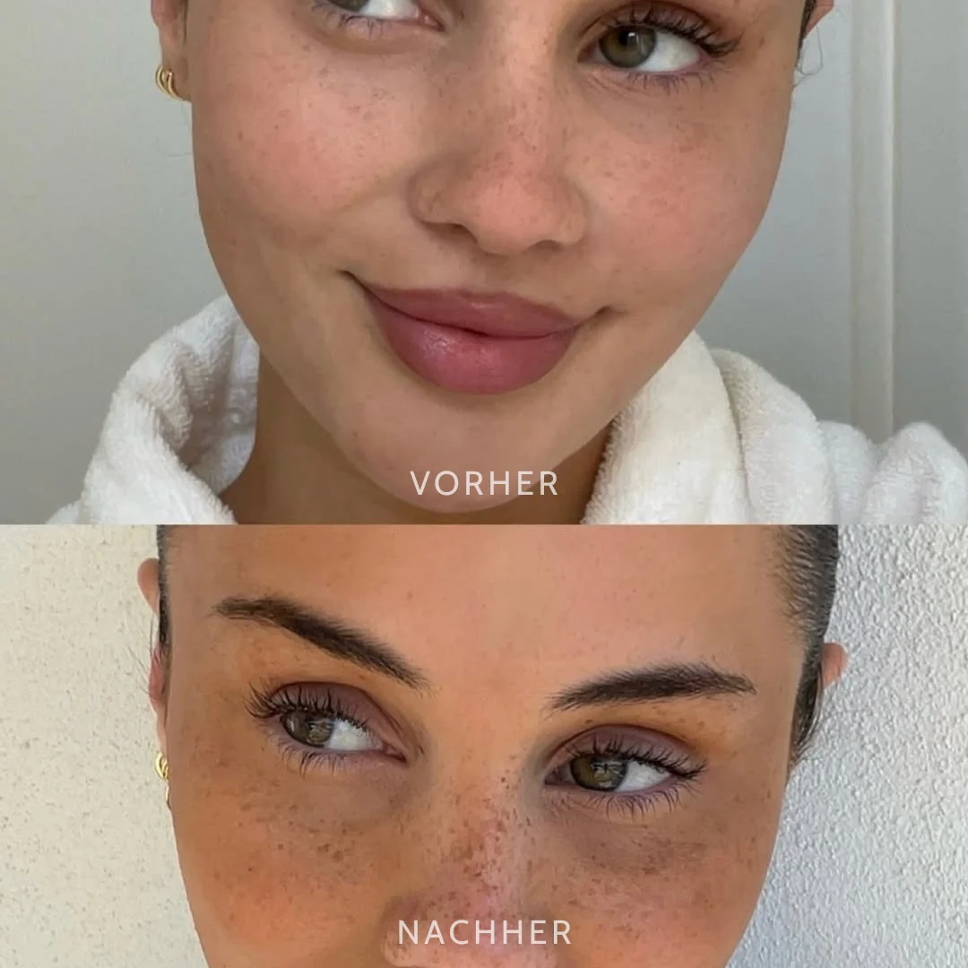 SonnenPunkte™ Verspielter Beauty-Akzent - Image 9